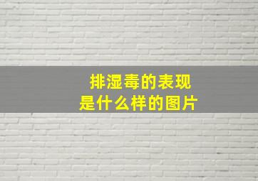 排湿毒的表现是什么样的图片