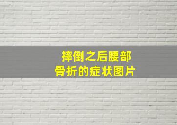 摔倒之后腰部骨折的症状图片